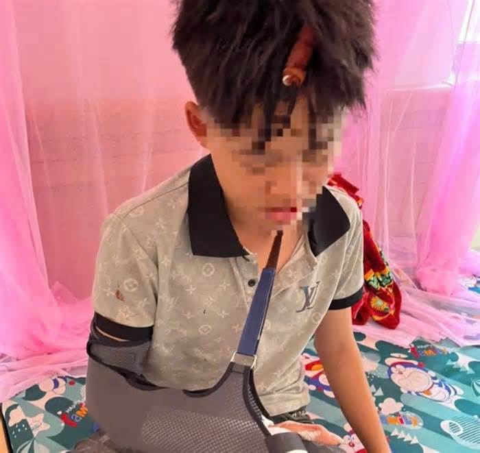 Công an xác minh vụ một học sinh lớp 8 bị đánh gãy xương