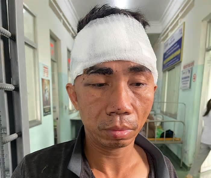 Bắt giam kẻ cướp tiệm vàng lẩn trốn trên đọt dừa ở Bình Định